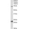 Potassium Intermediate Small Conductance Calcium Activated Channel Subfamily N, Member 2 (KCNN2) Antibody