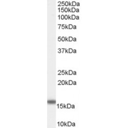 Fatty Acid-Binding Protein, Intestinal (FABP2) Antibody