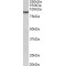 Fibroblast Growth Factor Receptor 1 (FGFR1) Antibody