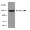 SLIT-ROBO Rho GTPase Activating Protein 2 (SRGAP2) Antibody