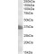 Protein FRG1 (FRG1) Antibody