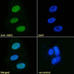 Gastrulation Brain Homeobox 2 (GBX2) Antibody