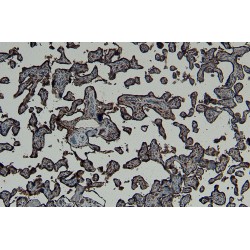 Gastrulation Brain Homeobox 2 (GBX2) Antibody