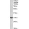 Rho GDP-Dissociation Inhibitor 3 (ARHGDIG) Antibody