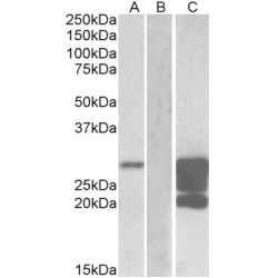 Ganglioside GM2 Activator (GM2A) Antibody