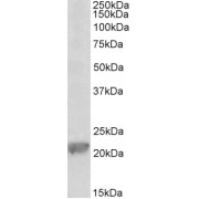 abx431302 (0.1g/ml) staining of Rat Liver lysate (35 µg protein in RIPA buffer). Primary incubation was 1 hour. Detected by chemiluminescence.