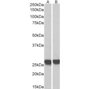 Biotinylated abx431305 (0.3 µg/ml) staining of MOLT4 (A) and Human Thymus (B) lysates (35 µg protein in RIPA buffer), exactly mirroring its parental non-biotinylated product. Primary incubation was 1 hour. Detected by chemiluminescence, using streptavidin-HRP and using NAP blocker as a substitute for skimmed milk.