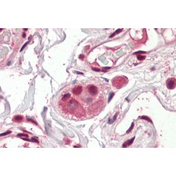 Amino-Terminal Enhancer of Split (AES) Antibody