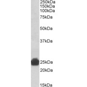 abx431312 (0.3 µg/ml) staining of Rat Liver lysate (35 µg protein in RIPA buffer). Primary incubation was 1 hour. Detected by chemiluminescence.