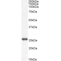 Glutathione S Transferase Mu 4 (GSTM4) Antibody