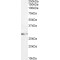 Glutathione S Transferase Mu 3 (GSTM3) Antibody