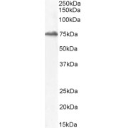 HEK293 overexpressing Human HIC1 and probed with abx431321 (0.5 µg/ml) with the mock transfection in second lane.