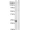 High Mobility Group Protein HMG-I/HMG-Y (HMGA1) Antibody