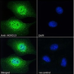 Homeobox Protein Hox-D13 (HOXD13) Antibody