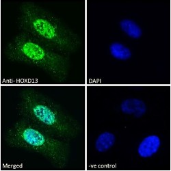 Homeobox Protein Hox-D13 (HOXD13) Antibody