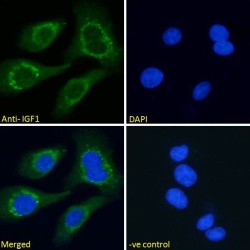 Insulin Like Growth Factor 1 (IGF1) Antibody