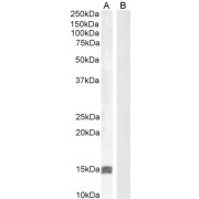 abx431351 (0.5 µg/ml) staining of Human Uterus (A) and negative control HepG2 (B) lysate (35 µg protein in RIPA buffer). Detected by chemiluminescence