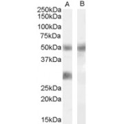 abx431354 (0.02 µg/ml) staining of Human Breast Cancer lysate (35 µg protein in RIPA buffer) with (B) and without (A) blocking with the immunising peptide. Primary incubation was 1 hour. Detected by chemiluminescence.