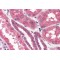 Inositol 1,4,5-Trisphosphate Receptor Type 2 (ITPR2) Antibody