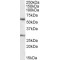 Potassium Voltage-Gated Channel Subfamily Q Member 1 (KCNQ1) Antibody