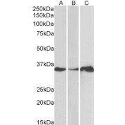 abx431379 (1 µg/ml) staining of Human Cerebellum (A), Colon (B) and Duodenum (C) lysate (35 µg protein in RIPA buffer). Primary incubation was 1 hour. Detected by chemiluminescence