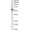 Phosphatidylcholine-Sterol Acyltransferase (LCAT) Antibody