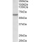 Proto-Oncogene Tyrosine-Protein Kinase LCK (LCK) Antibody