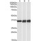 Lactate Dehydrogenase B (LDHB) Antibody