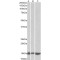 Galectin 1 (LGALS1) Antibody