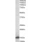 Galectin 1 (LGALS1) Antibody