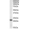 Proteasome Subunit Beta Type 8 (PSMB8) Antibody