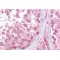 LIM Homeobox Transcription Factor 1 Beta (LMX1B) Antibody