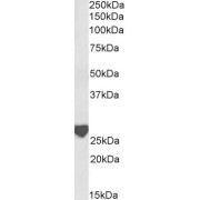 Western blot analysis of Rat Brain lysate (35 µg protein in RIPA buffer) using biotin-conjugated Latexin Antibody (0.3 µg/ml, 1 hour). Detected by chemiluminescence, using streptavidin-HRP and using NAP blocker as a substitute for skimmed milk.