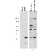 N2a overexpressing Mouse Znrf1 (mock transfection in first lane) and probed with abx431405 (1 µg/ml), also staining of Mouse Brain lysates (Embryo E14 and adult cerebellum). Primary incubation was 1 hour. Detected by chemiluminescence.