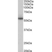 abx431418 (0.3 µg/ml) staining of Human Heart lysate (35 µg protein in RIPA buffer). Detected by chemiluminescence.