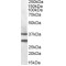 Melanocortin Receptor 5 (MC5R) Antibody