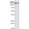 Guanine Nucleotide Exchange Factor DBS (MCF2L) Antibody