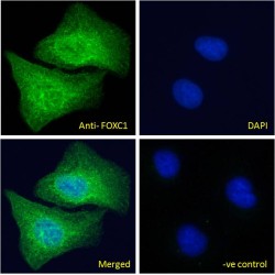 Forkhead Box Protein C1 (FOXC1) Antibody