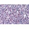 Forkhead Box Protein C1 (FOXC1) Antibody