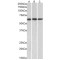 Matrix Metalloproteinase 14 (MMP14) Antibody