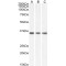 Malate Dehydrogenase 2 (MDH2) Antibody