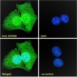 Myeloid Differentiation Primary Response Protein MyD88 (MYD88) Antibody