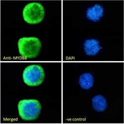 Myeloid Differentiation Primary Response Protein MyD88 (MYD88) Antibody