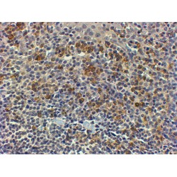 Myeloid Differentiation Primary Response Protein MyD88 (MYD88) Antibody