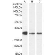 abx431443 staining (0.2 µg/ml) staining of HumanThymus (A) and (0.1 µg/ml) Human Spleen (B) and Mouse Thymus lysate (35 µg protein in RIPA buffer). Detected by chemiluminescence.