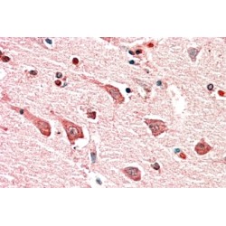Myosin IB (MYO1B) Antibody