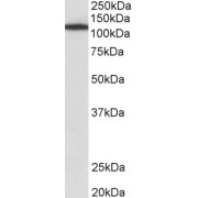 abx431445 (1 µg/ml) staining of NIH3T3 lysate (35 µg protein in RIPA buffer). Primary incubation was 1 hour. Detected by chemiluminescence.