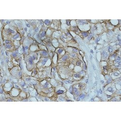 Protein NDRG1 (NDRG1) Antibody