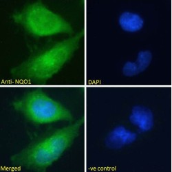 NAD(P)H Dehydrogenase, Quinone 1 (NQO1) Antibody