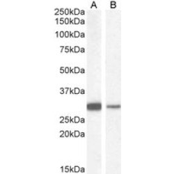 NAD(P)H Dehydrogenase, Quinone 1 (NQO1) Antibody